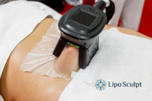 Cryolipolysis Helping You Getting that Perfect Summer Body 3 Cryolipolysis Salford Priors can give you the best summer body - contact us today!